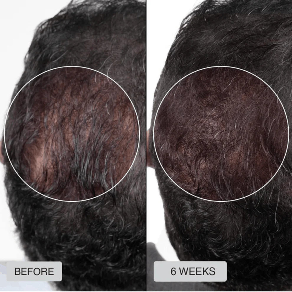 HairLux Therapy Cap