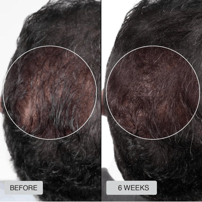 HairLux Therapy Cap