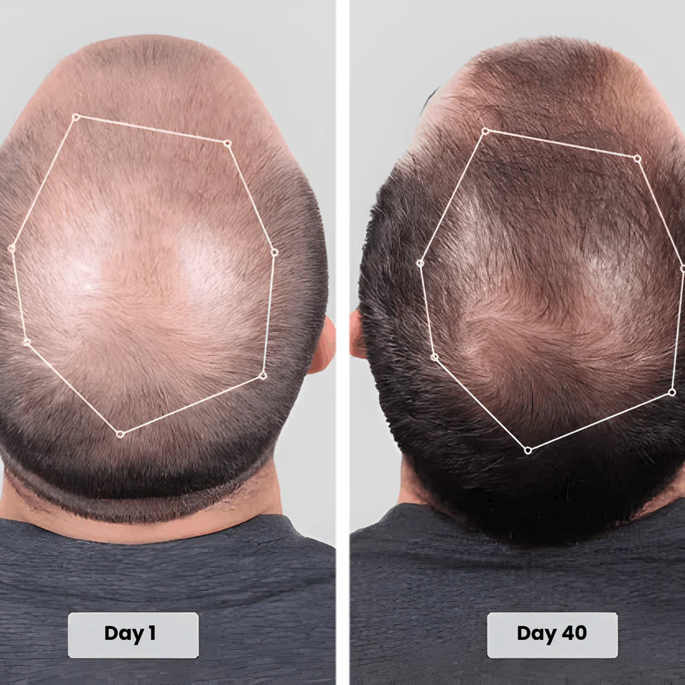 HairLux Therapy Cap