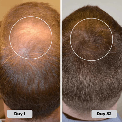 HairLux Therapy Cap