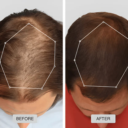 HairLux Therapy Cap