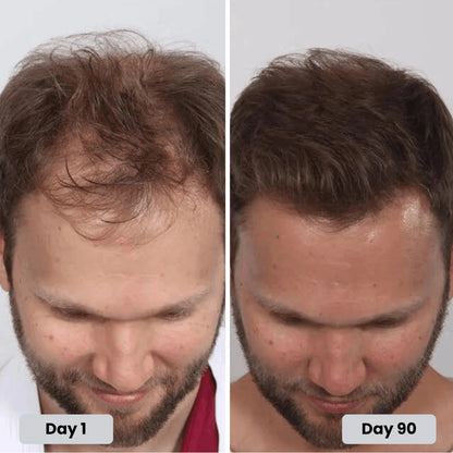 HairLux Therapy Cap
